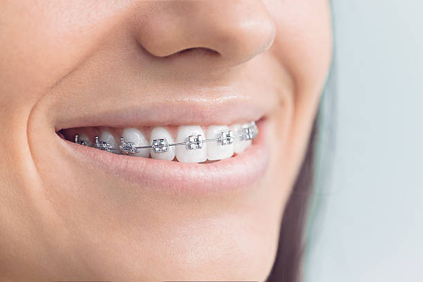 Best Invisalign and Clear Aligners  in Alamosa, CO